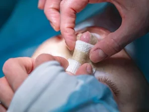 عوارض راینوپلاستی + نکات مهم