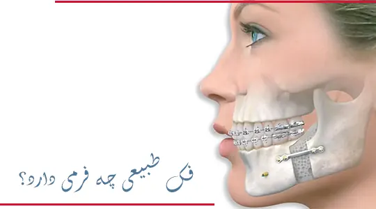 فرم فک طبیعی