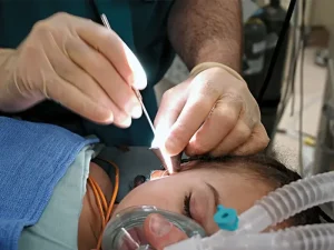 مراقبت جراحی زیبایی گوش