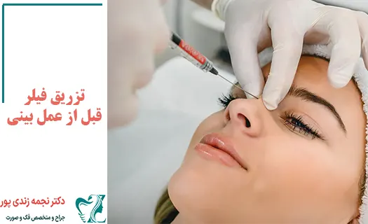 تزریق فیلر قبل از عمل بینی تزریق فیلر قبل از عمل بینی