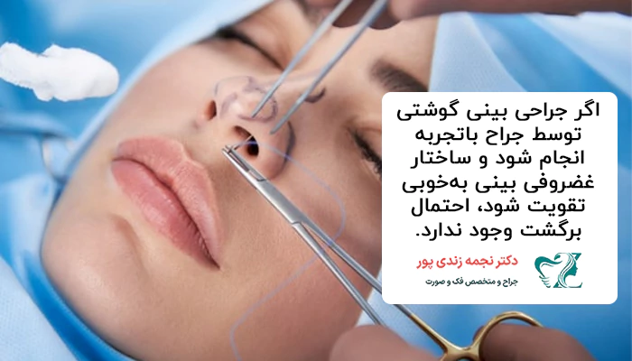 برگشت بینی گوشتی بعد از عمل
