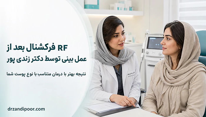 rf فرکشنال بعد از عمل بینی