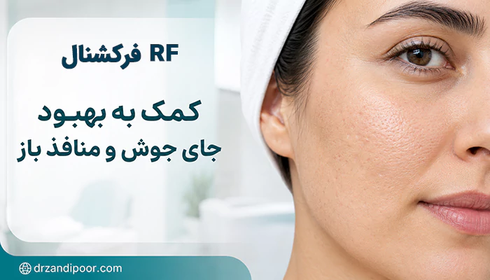 آر اف فرکشنال