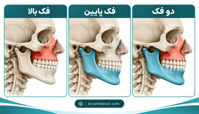 مقایسه جراحی فک بالا، فک پایین و جراحی دو فک با نمایش ساختار استخوانها
