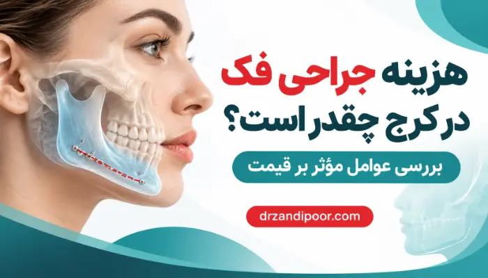 هزینه جراحی فک در کرج و بررسی عوامل مؤثر بر قیمت عمل فک